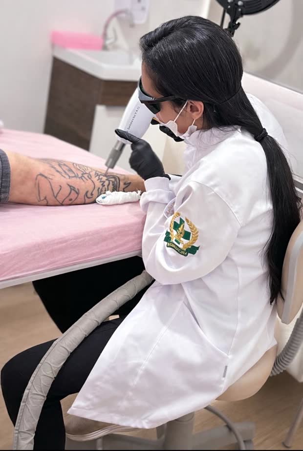 Remoção a laser — Nádia Benevides Studio